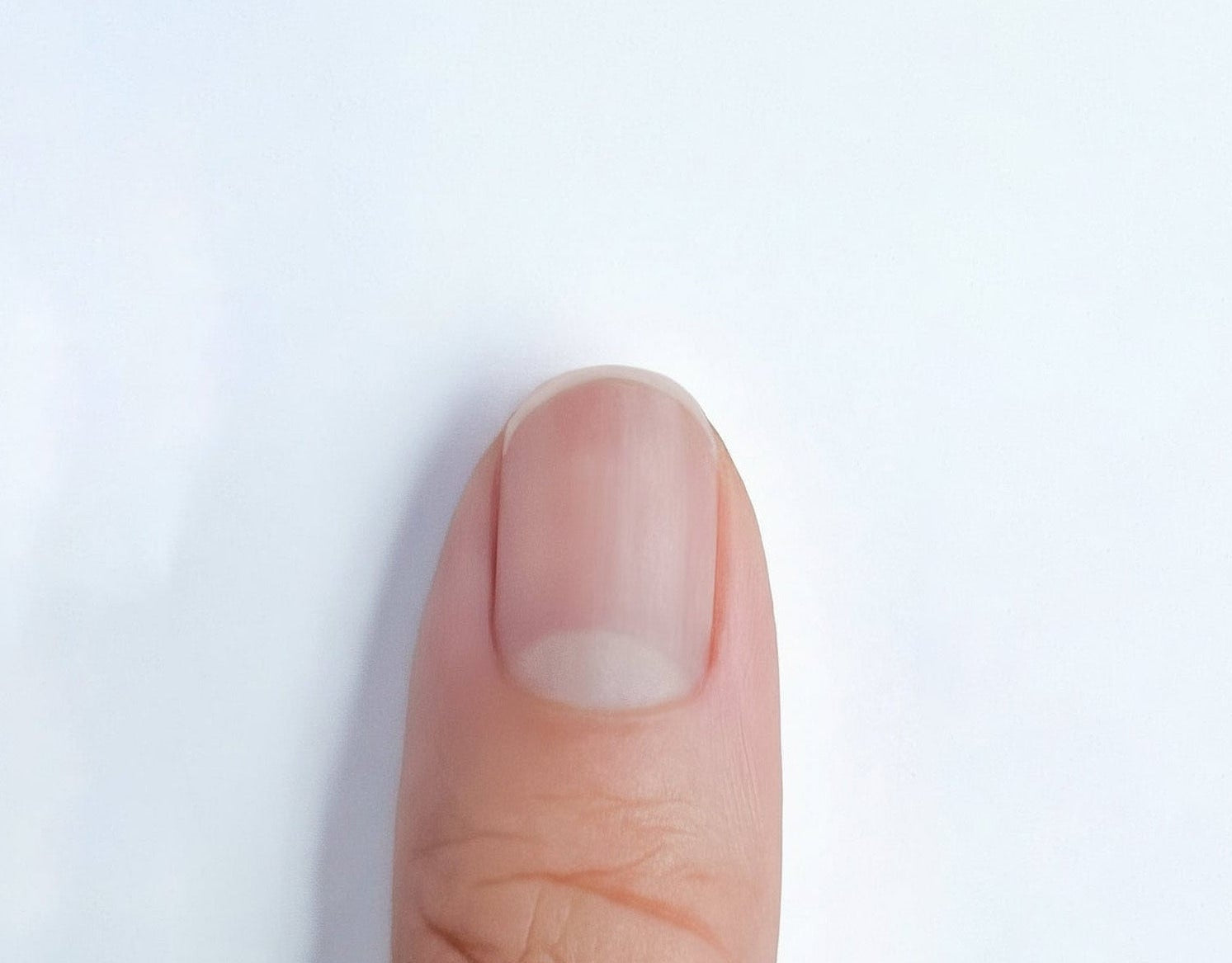Close-up of a finger with a small white spot on a light gray background